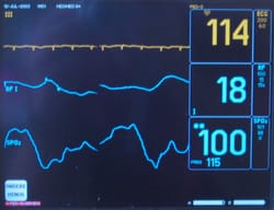 Using Home Assistant Device Trackers to watch the Critical Components of your Smart Home